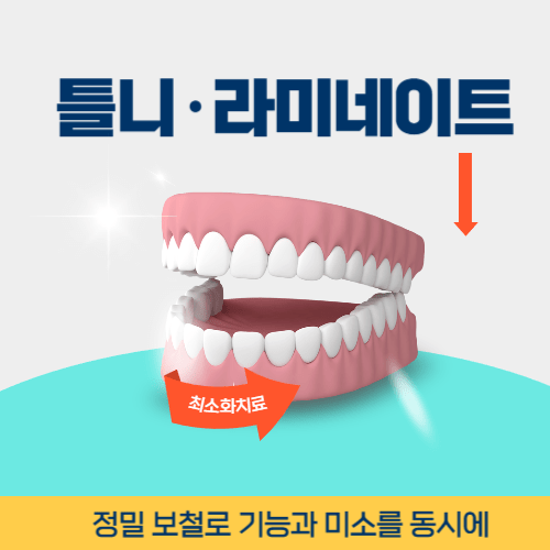 영주치과 영주시 치과 틀니 라미네이트