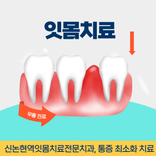영주치과 영주시 치과 잇몸치료